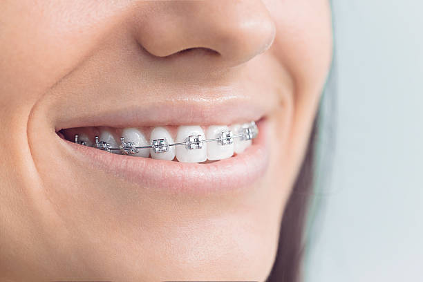 Best Dentures (Full and Partial)  in Des Allemands, LA